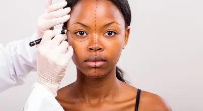 Rhinoplasty (Nose Surgery)